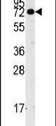 CASC3 Antibody in Western Blot (WB)