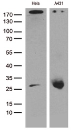 CAV1 Antibody in Western Blot (WB)