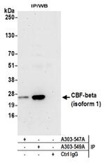 CBF-beta (isoform 1) Antibody in Western Blot (WB)