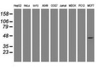 CBX8 Antibody in Western Blot (WB)