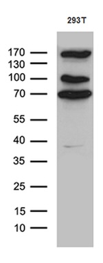 CCDC22 Antibody in Western Blot (WB)