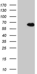 CCDC36 Antibody in Western Blot (WB)