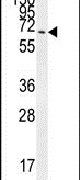 CCDC37 Antibody in Western Blot (WB)