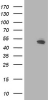 CCM2 Antibody in Western Blot (WB)