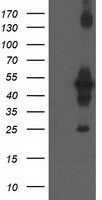 CCM2 Antibody in Western Blot (WB)