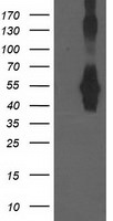 CCM2 Antibody in Western Blot (WB)