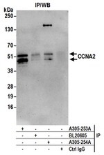 CCNA2/Cyclin A2 Antibody in Immunoprecipitation (IP)