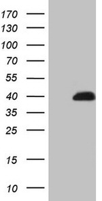 CCND2 Antibody in Western Blot (WB)