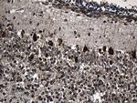 CCT4 Antibody in Immunohistochemistry (Paraffin) (IHC (P))