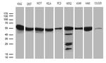 CCT4 Antibody in Western Blot (WB)