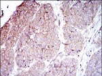 CD104 Antibody in Immunohistochemistry (Paraffin) (IHC (P))