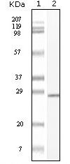 c-Kit Antibody in Western Blot (WB)