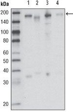 RON Antibody in Western Blot (WB)