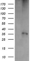 CD1C Antibody in Western Blot (WB)