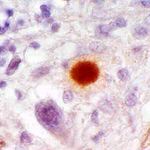 PrP Antibody in Immunohistochemistry (Paraffin) (IHC (P))