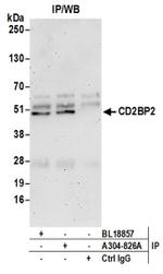 CD2BP2 Antibody in Western Blot (WB)