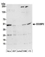 CD2BP2 Antibody in Western Blot (WB)