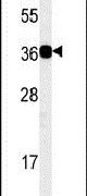 CD300b Antibody in Western Blot (WB)