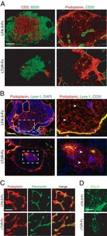 CD31 Antibody in Immunohistochemistry (IHC)