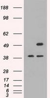 CD4 Antibody in Western Blot (WB)