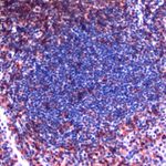 CD43 Antibody in Immunohistochemistry (IHC)