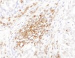 CD45 Antibody in Immunohistochemistry (IHC)