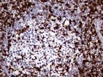 CD45RO Antibody in Immunohistochemistry (Paraffin) (IHC (P))