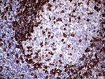 CD45RO Antibody in Immunohistochemistry (Paraffin) (IHC (P))