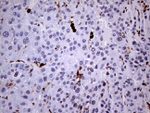 CD45RO Antibody in Immunohistochemistry (Paraffin) (IHC (P))