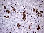 CD45RO Antibody in Immunohistochemistry (Paraffin) (IHC (P))