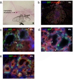 CD49b (Integrin alpha 2) Antibody in Immunohistochemistry (IHC)