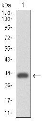 ITGA4 Antibody in Western Blot (WB)