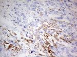 CD68 Antibody in Immunohistochemistry (Paraffin) (IHC (P))