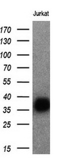 CD7 Antibody in Western Blot (WB)