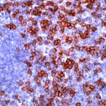 CD8 Antibody in Immunohistochemistry (Paraffin) (IHC (P))