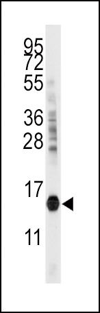 CDA Antibody in Western Blot (WB)