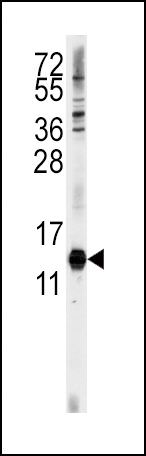 CDA Antibody in Western Blot (WB)