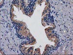 CDCP1 Antibody in Immunohistochemistry (Paraffin) (IHC (P))