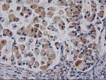 CDCP1 Antibody in Immunohistochemistry (Paraffin) (IHC (P))