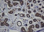 CDH1 Antibody in Immunohistochemistry (Paraffin) (IHC (P))