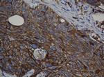 CDH1 Antibody in Immunohistochemistry (Paraffin) (IHC (P))