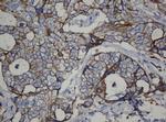 CDH1 Antibody in Immunohistochemistry (Paraffin) (IHC (P))