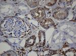 CDH1 Antibody in Immunohistochemistry (Paraffin) (IHC (P))