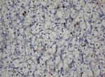 CDH1 Antibody in Immunohistochemistry (Paraffin) (IHC (P))