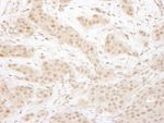 CDK4 Antibody in Immunohistochemistry (IHC)