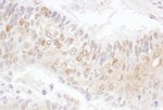 CDK4 Antibody in Immunohistochemistry (IHC)