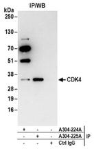 CDK4 Antibody in Western Blot (WB)