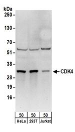 CDK4 Antibody in Western Blot (WB)