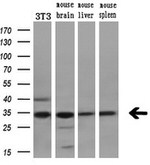 CDK5 Antibody in Western Blot (WB)