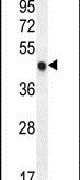 p57 Kip2 Antibody in Western Blot (WB)